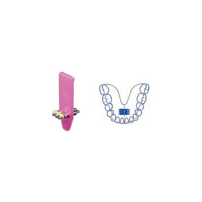 Universal screw