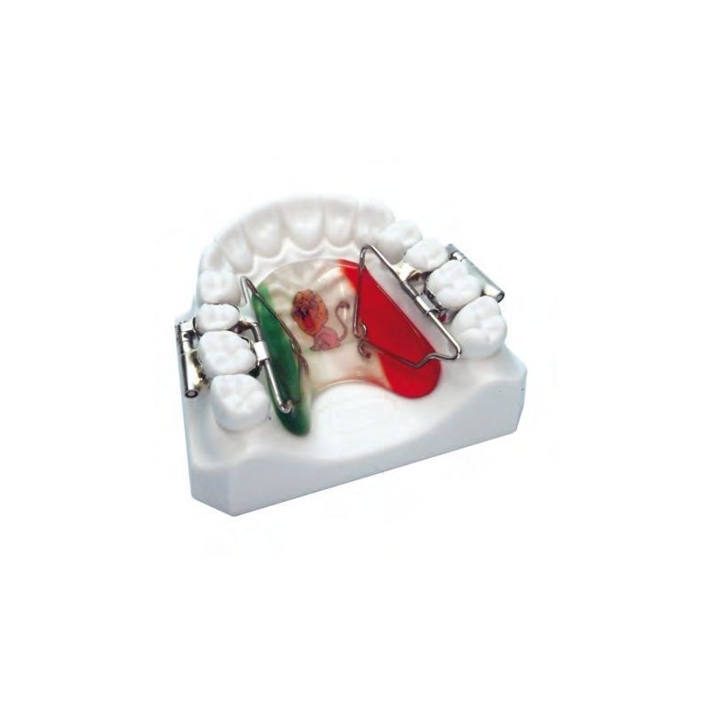 Rapid molar distalizer "First Class" Rapid molar distalizer "First Class"