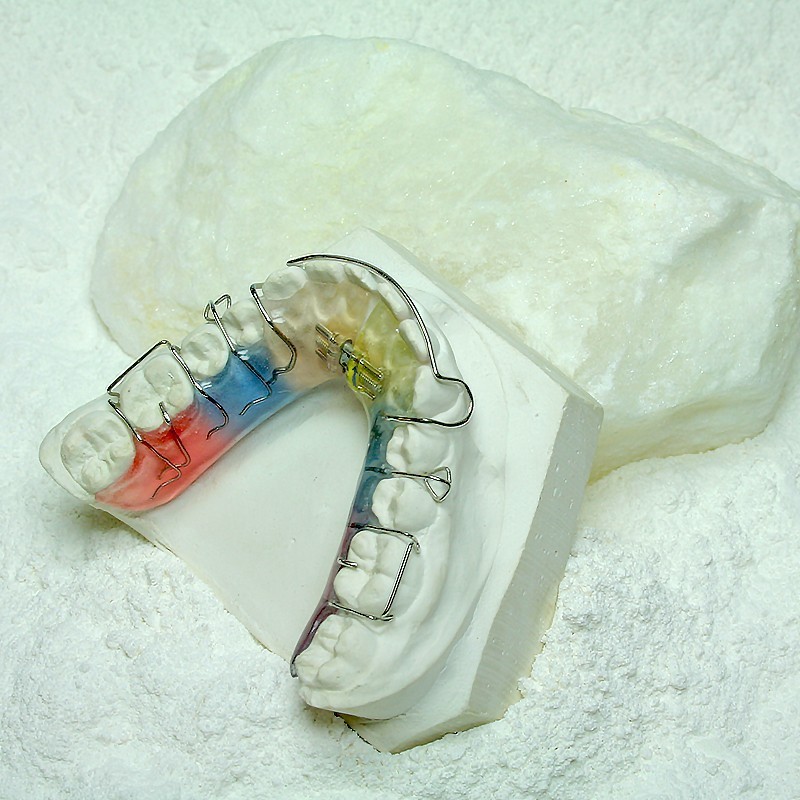 Dental gypsum type 3 "Natura" (orthodontics) Dental gypsum type 3 "Natura" (orthodontics)