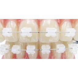 Ceramic brackets "AQUA" (ROT / слот 22) - сет 20 бр.
