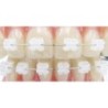 Ceramic brackets "AQUA" (ROT / slot 22) - kit 20 pcs.