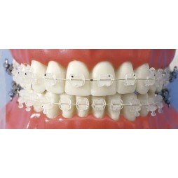 D.B. brackets "NATURA" in siliceous copolymer (Roth / slot 22) - kit 20 pcs.
