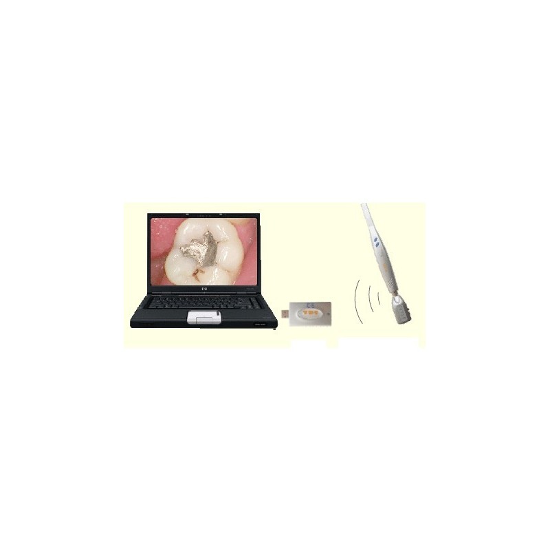 Set intraoral camera (1.3 Mp) TDS, wireless USB
