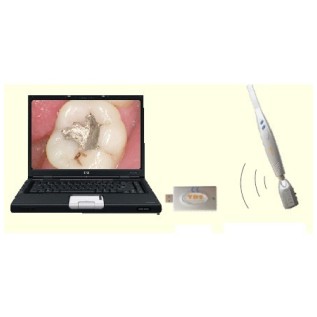Set intraoral camera (1.3 Mp) TDS, wireless USB
