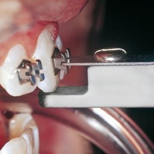 Universal bracket positioning gauge