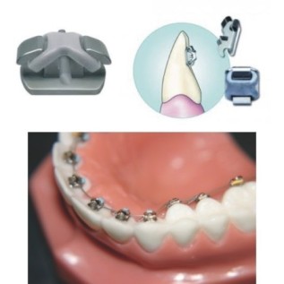 IDEA-L lingual brackets (kit 4/4) - 8 pcs.