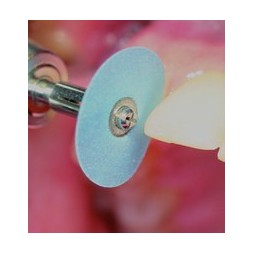 Flexible polishing discs "EVE FLEXI-D" (diam. 14mm) - composites, gold, amalgam assorted set