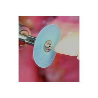 Flexible polishing discs "EVE FLEXI-D" (diam. 14mm) - composites, gold, amalgam assorted set