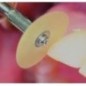 Flexible polishing discs "EVE FLEXI-D" (diam. 14mm) - composites, gold, amalgam assorted set