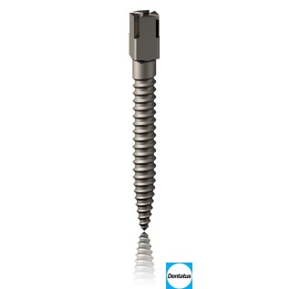 Root canal titanium classic post Surtex (Dentatus)