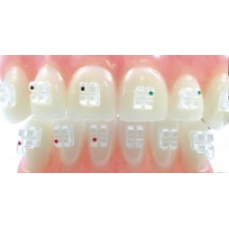 D.B. aesthetic sapphire "GHIACCIO / Roth" brackets - set 20 pcs.