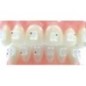 D.B. aesthetic sapphire "GHIACCIO / Roth" brackets - set 20 pcs.