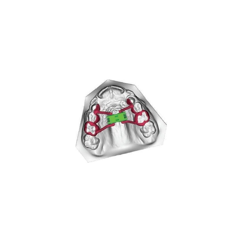 Anatomical expansion screw CAD CAM 3D frame Anatomical expansion screw CAD CAM 3D frame