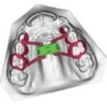 Anatomical expansion screw CAD CAM 3D frame