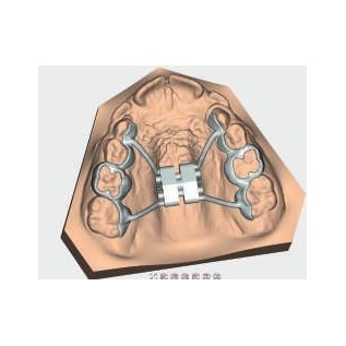 Винт експандер стандартен за CAD-CAM 3D